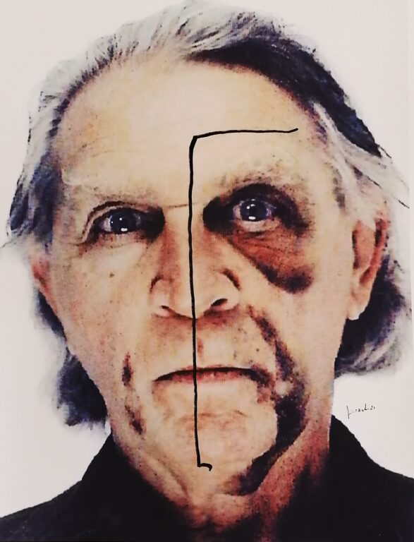 Self-Portrait with Black Eye and Bruises #4 - Jimmie Durham 