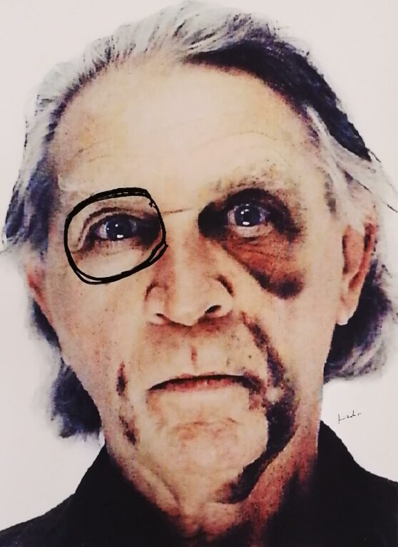 Self-Portrait with Black Eye and Bruises #5 - Jimmie Durham 