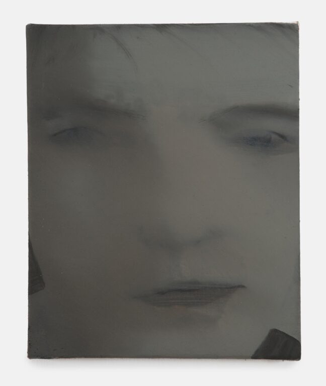 “Walter Freeman’s Patient, American Woman in the 1940s” - Julien Heintz 