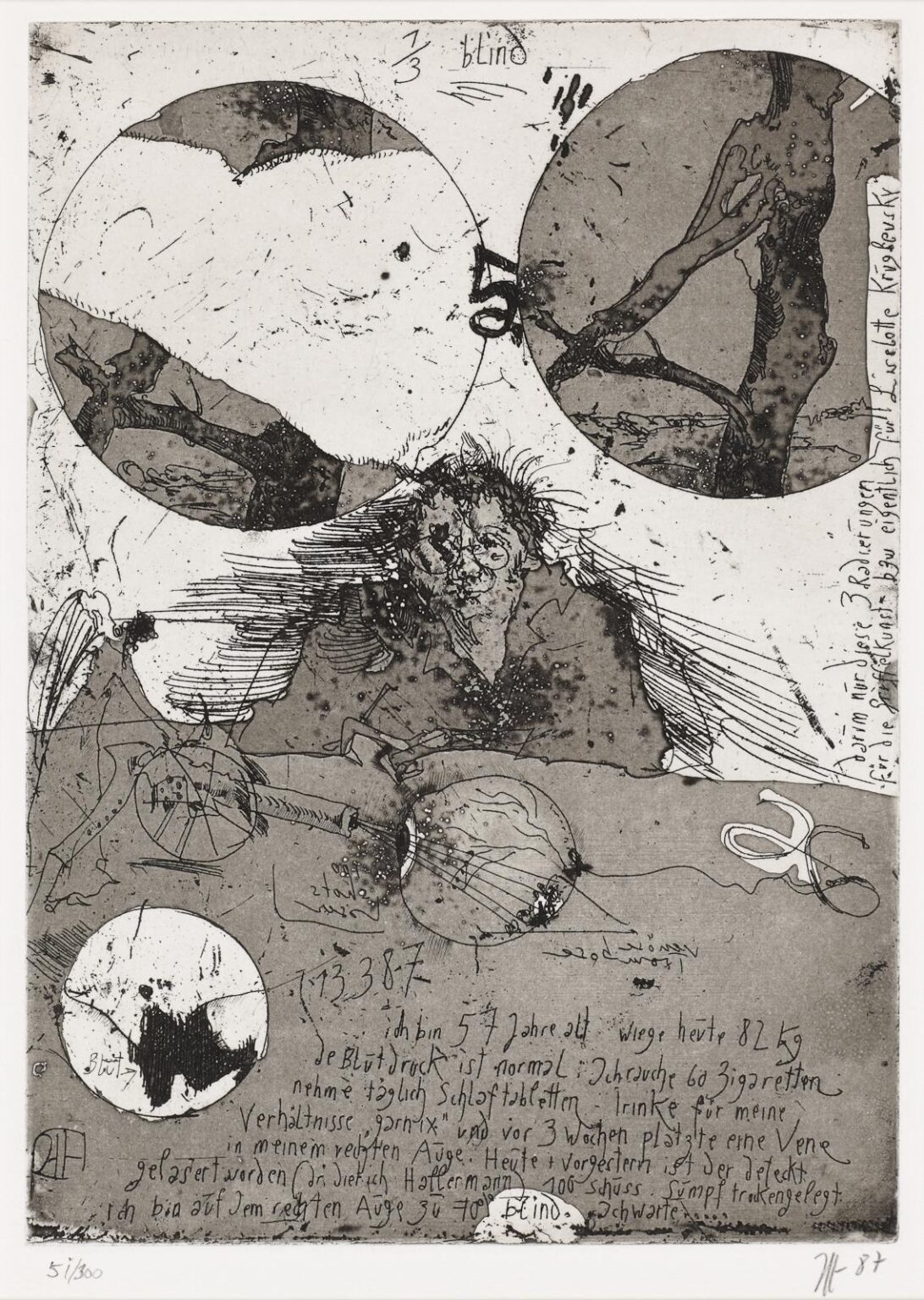 1/3 blind / 13.3.87 - Horst Janssen 