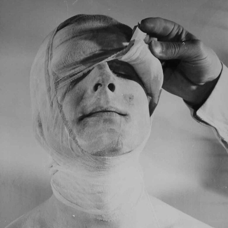 3. Aktion - Rudolf Schwarzkogler 